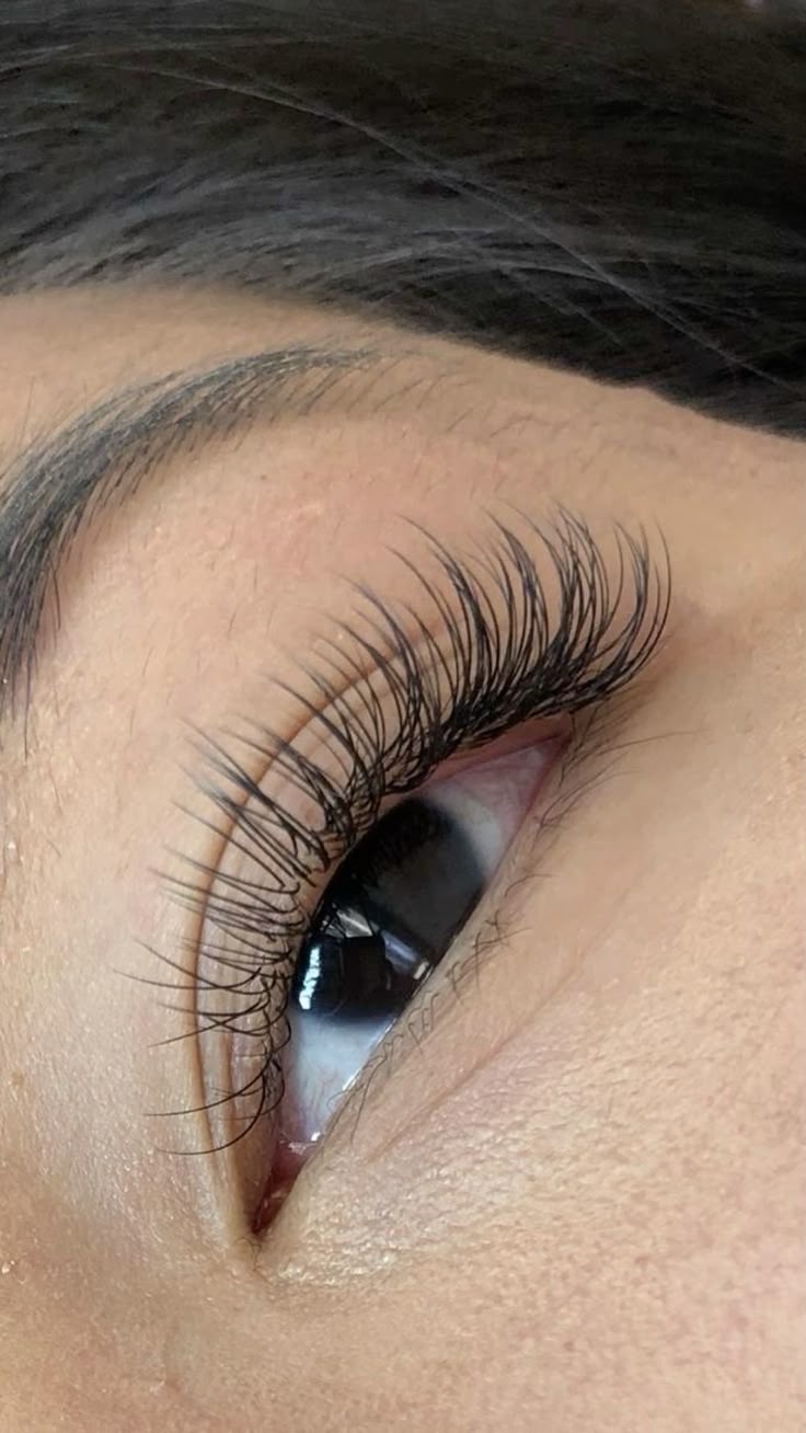 Extensiones Clásicas